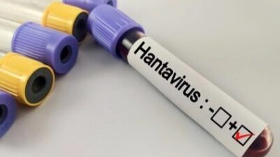 Hantavirüs salgına dönüşür mü? Kapalı alan temizliğinde büyük risk Enfeksiyon Hastalıkları Uzmanı Saliha Ayan, kemirgen temasıyla bulaşan hantavirüse karşı