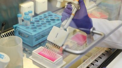 Bursa Teknik Üniversitesi, TÜSEB desteğiyle diyabet hastalarında sık görülen iyileşmeyen